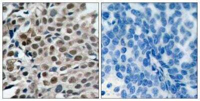 Immunohistochemistry-Paraffin: FOXO3 [p Ser253] Antibody [NB100-81929]